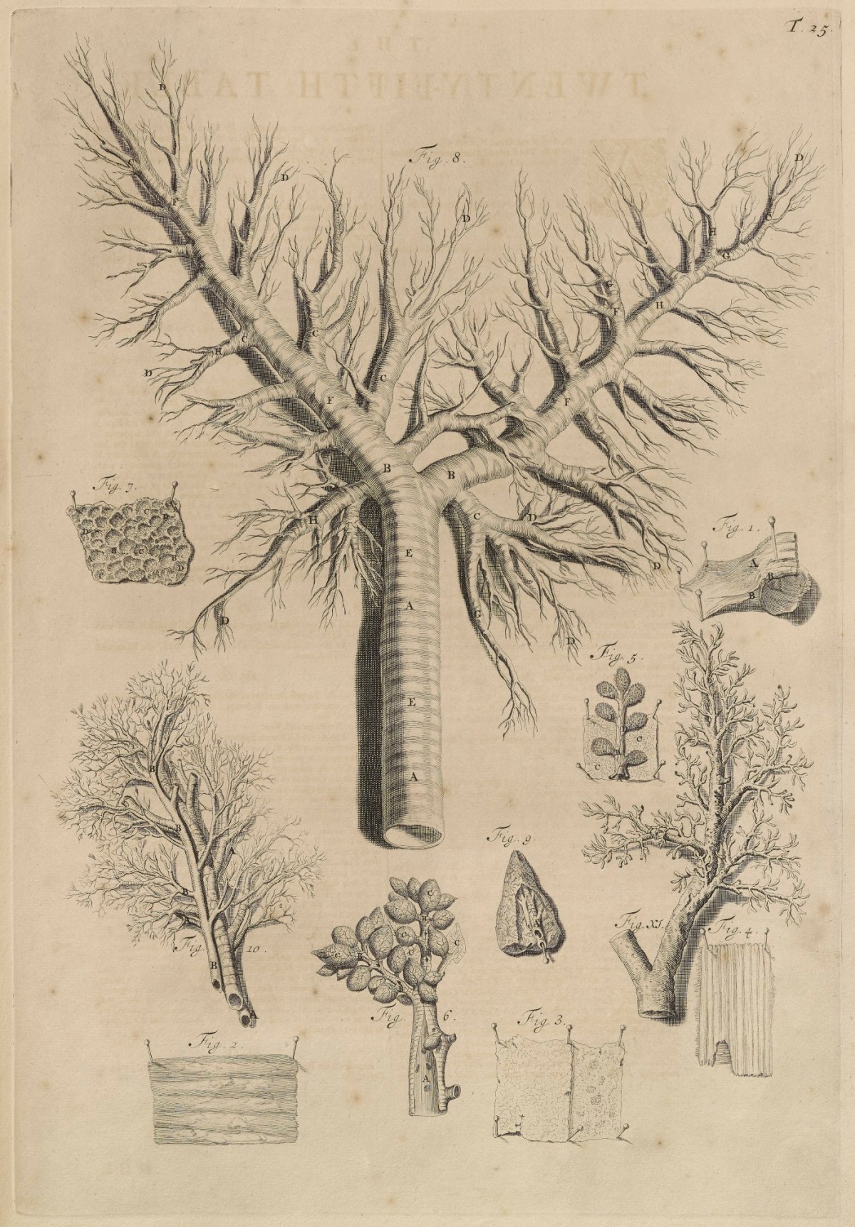 Samuel Smith and Benjamin Walford, Plate 25: Wind Pipe and Bronchia