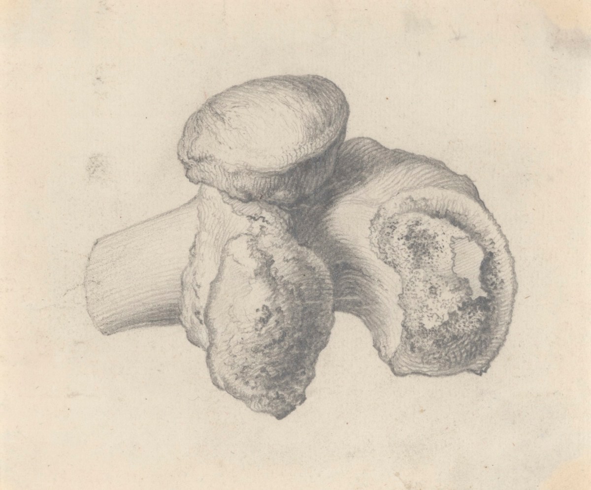 Gerard van der Gucht, The lower end of the femur, showing an anchylosis, for Cheselden's Osteographia