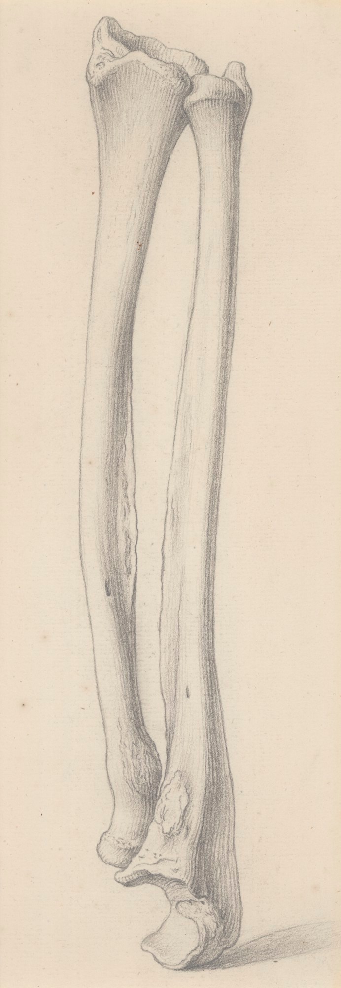 Drawing of the radius and ulna bones fused together, for Cheselden's