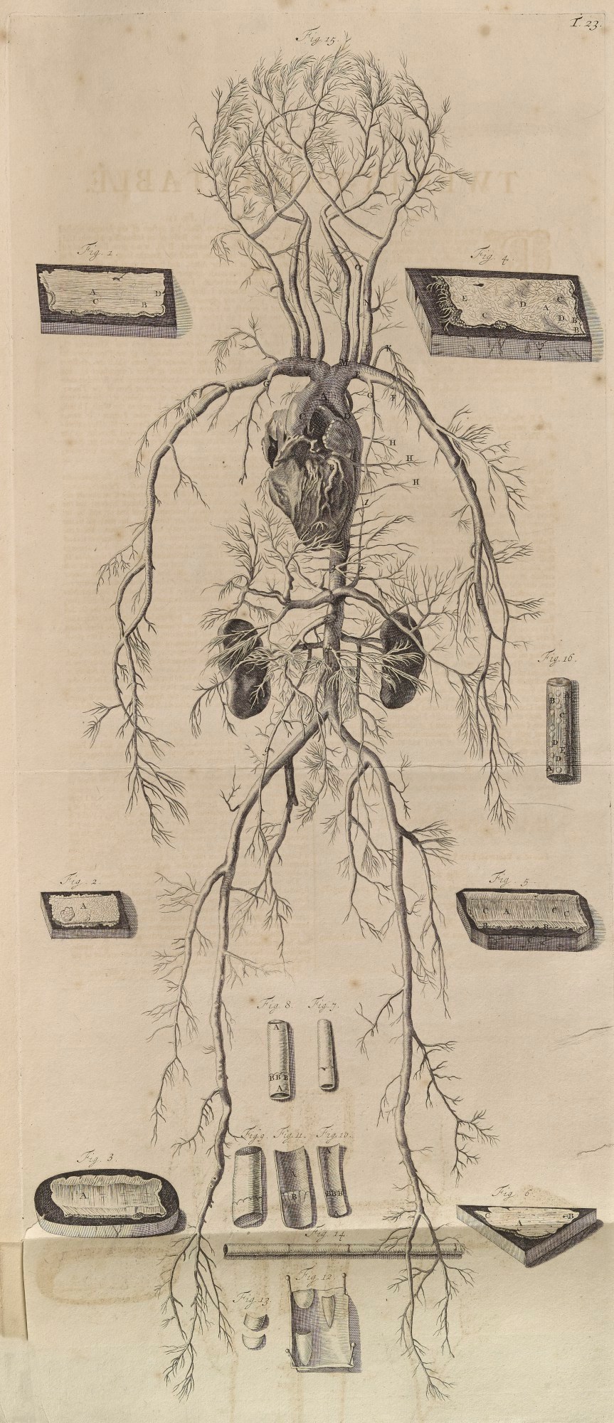 Samuel Smith and Benjamin Walford, Plate 23: System of arteries of a six month old infant