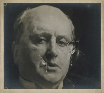 J.S. Sargent RA, Detail of the portrait of Henry James O.M. after being damaged by a suffragette, May 1914